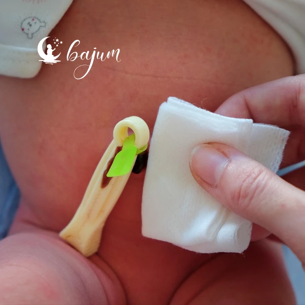 Co to jest kikut pępowinowy i jak prawidłowo pielęgnować pępek noworodka?