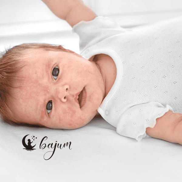 Jak rozpoznać alergię u niemowlaka? Sprawdź najczęstsze objawy alergii u niemowląt i dzieci