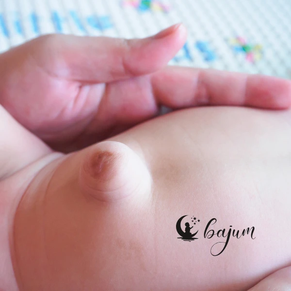 Co to jest przepuklina pępkowa u niemowląt? Przyczyny, objawy i leczenie