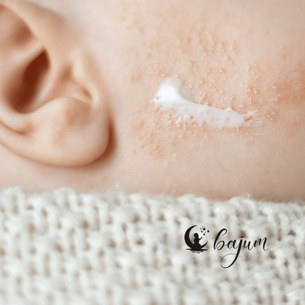 Jak stosować maść majerankową na katar u dziecka?